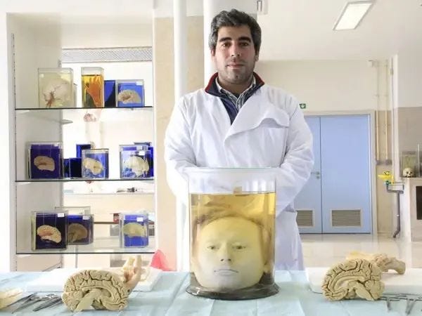 Preserved head of Diogo Alves