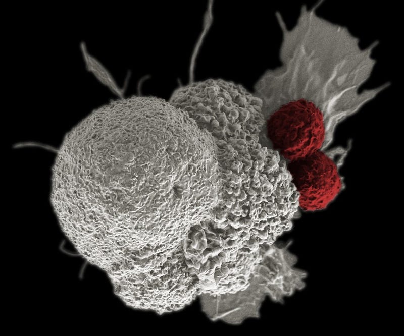 T Cells Targeting Cancer Cells