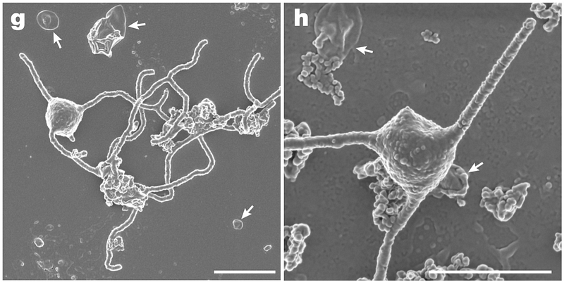 Microscopic View of Prometheoarchaeum's Membrane Protrusions